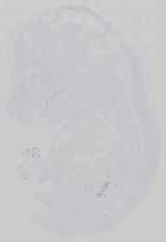 EMAGE:14486