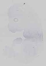 EMAGE:14518