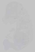 EMAGE:14527