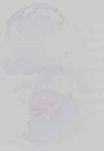 EMAGE:14529