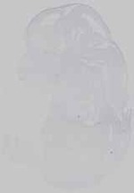 EMAGE:14544