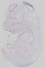 EMAGE:14549