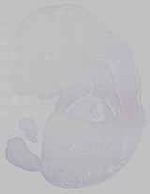 EMAGE:14566