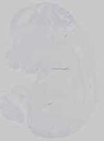 EMAGE:14567