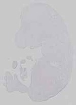 EMAGE:14570