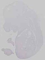 EMAGE:14574