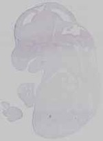 EMAGE:14593