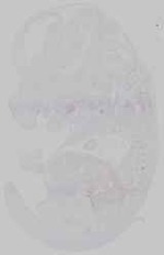 EMAGE:14612