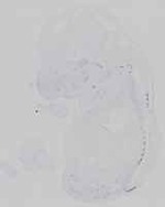 EMAGE:14623