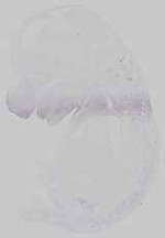 EMAGE:14623
