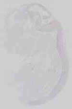 EMAGE:14628