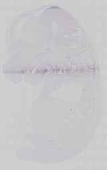 EMAGE:14628