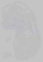 EMAGE:14634