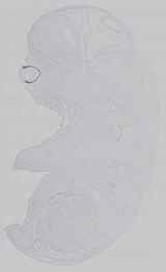 EMAGE:14643