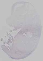 EMAGE:14646