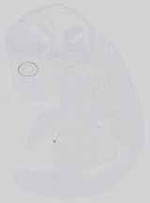 EMAGE:14665