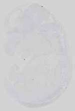EMAGE:14665