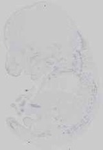 EMAGE:14689