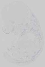 EMAGE:14689