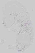 EMAGE:14689