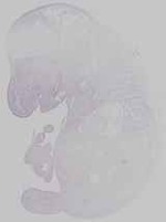 EMAGE:14698