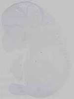 EMAGE:14701