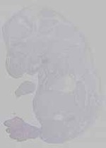 EMAGE:14707