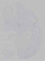 EMAGE:14707