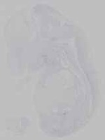 EMAGE:14707