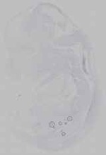 EMAGE:14707