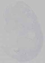 EMAGE:14707