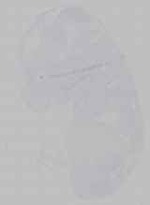 EMAGE:14707