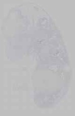 EMAGE:14707
