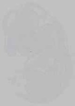 EMAGE:14709