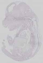 EMAGE:14725
