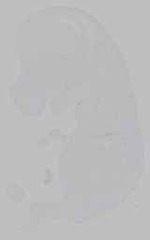 EMAGE:14728