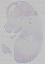 EMAGE:14732