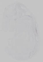 EMAGE:14738