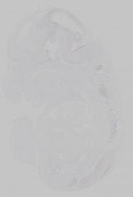 EMAGE:14738