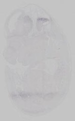 EMAGE:14745