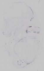 EMAGE:14749