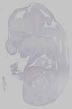 EMAGE:14760