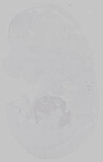 EMAGE:14760