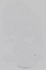 EMAGE:14778
