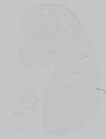 EMAGE:14778