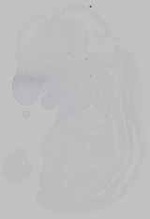 EMAGE:14781