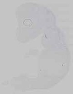 EMAGE:14781