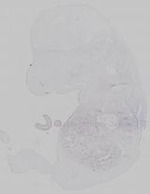 EMAGE:14789