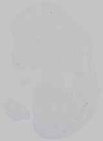 EMAGE:14793
