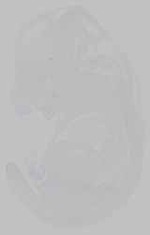 EMAGE:14818